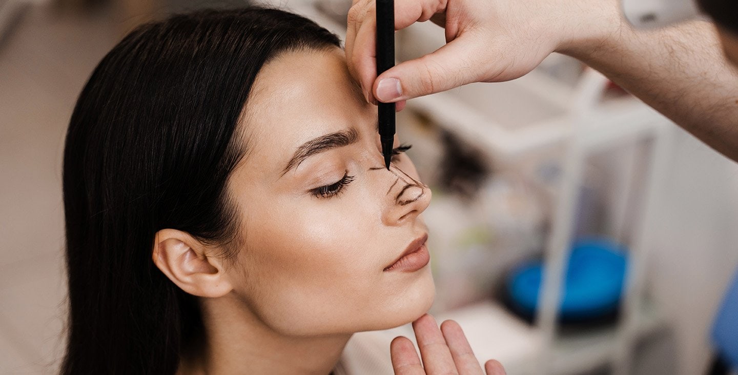 Rhinoplasty surgery markings by Dr. Bonaparte in Ottawa